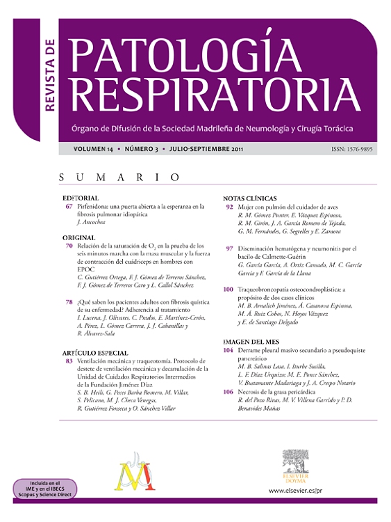 Go to journal home page - Revista de Patología Respiratoria